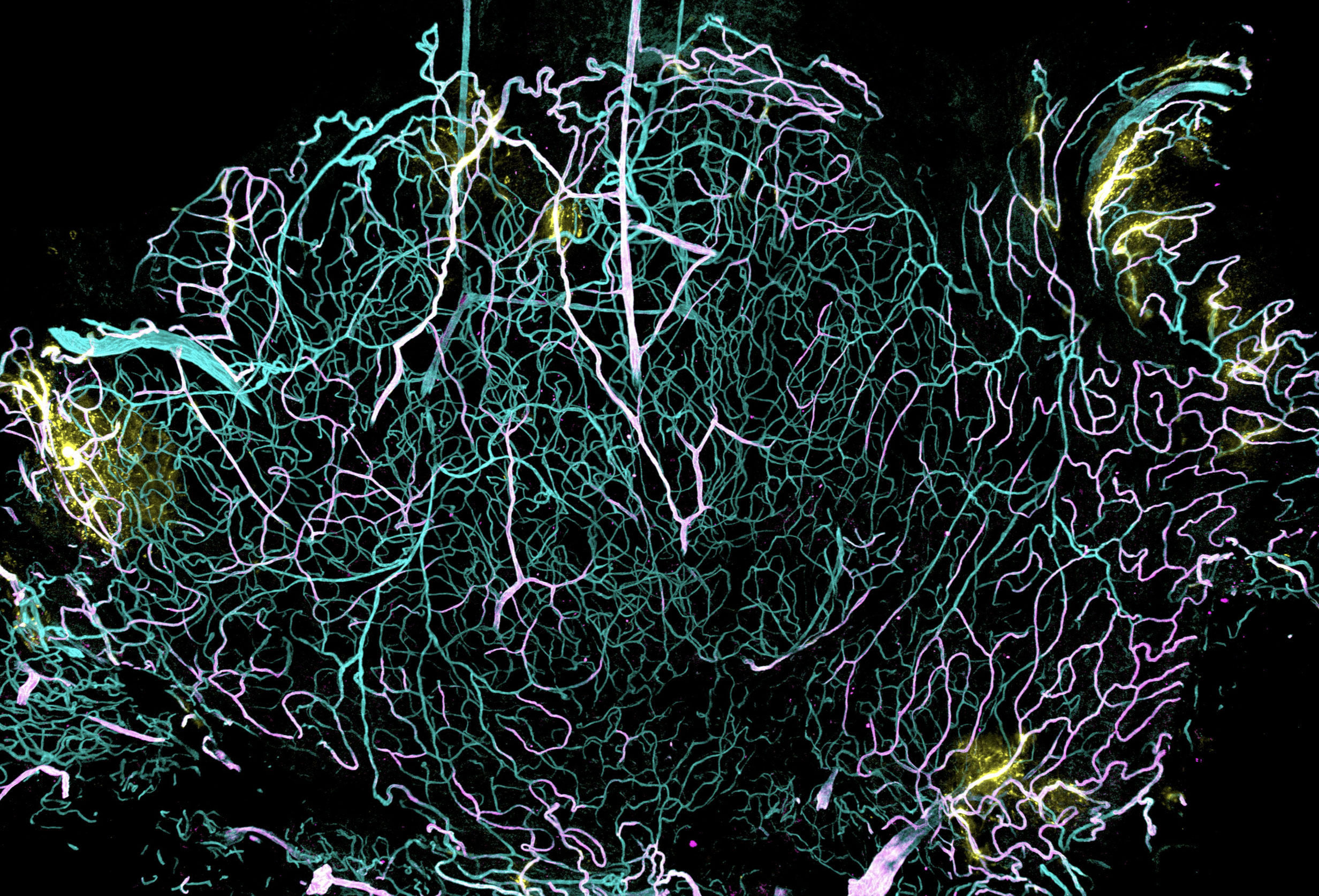 関節の三次元可視化が明らかにする血液関節関門の存在